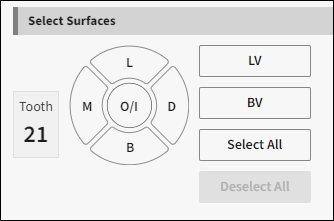 Select Surfaces image showing the condition options of LV, BV, select all and deselect all.